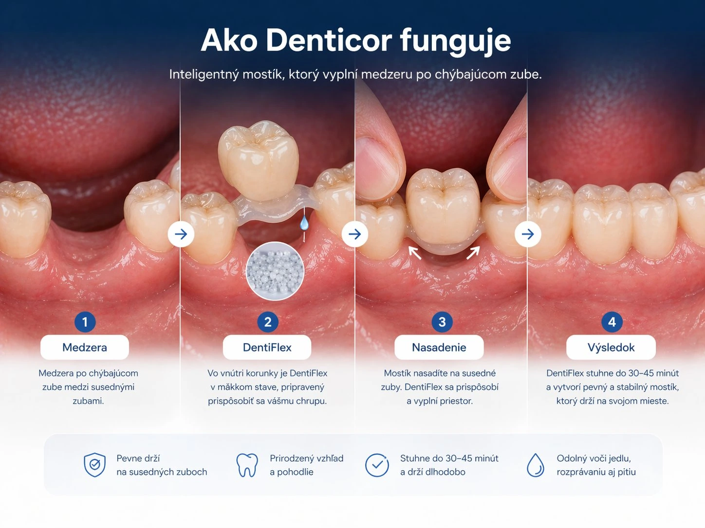 Jak Denticor funguje v případě chybějících tří horních předních zubů