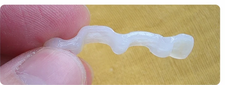 Ukázka nasazení Denticor: umístění náhrady a tvarování jejího nosiče DentiFlex · 2