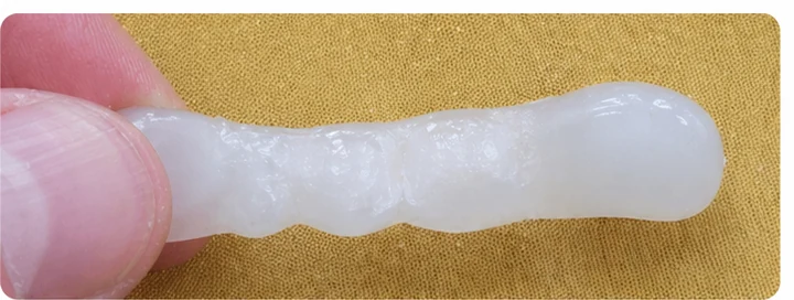 Ukázka nasazení Denticor: umístění náhrady a tvarování jejího nosiče DentiFlex · 2
