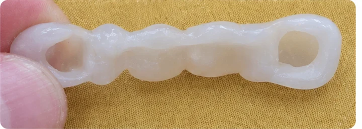 Ukázka nasazení Denticor: umístění náhrady a tvarování jejího nosiče DentiFlex · 4