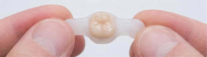 Vizuální návod – chybějící horní špičák a premolár